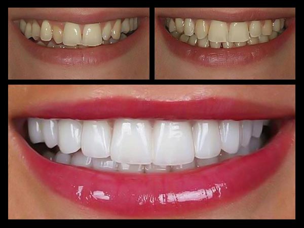 ORTHODONTICS TREATMENT