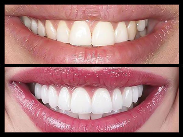 COSMETIC DENTISTRY